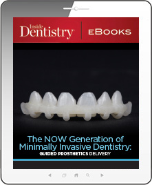 The NOW Generation of Minimally Invasive Dentistry: Guided Prosthetics Delivery Ebook Cover