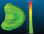 Fig 15. The 3D printed dentures are scanned into CAD software to assess the fidelity to the digital design file. Red is least accurate and green is most accurate. Clearly, the polyjet 3D printing process produced extremely high dimensional accuracy.