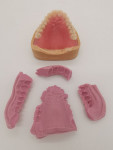 Fig 28. The devested denture prior to removal from the model (check of articulation movements).