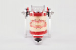 Fig 32 and Fig 33. The finished dentures in the articulator.