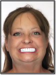 Fig 13. Smile photographs for laboratory submission and initial digital smile design.
