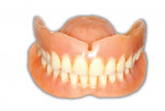 Fig 14. The existing denture as represented in the patient’s smile.